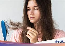 Rambut Kering Kekurangan Vitamin Apa